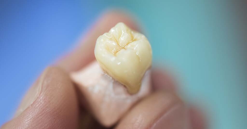 What are dental crowns? - Haight Family Dentistry Plano Dentist Dentist in Plano Melissa Dentist Dentist in Melissa